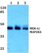 MAP2K4 Antibody in Western Blot (WB)
