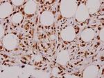 STAT3 Antibody in Immunohistochemistry (Paraffin) (IHC (P))