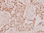 Synaptotagmin 1 Antibody in Immunohistochemistry (Paraffin) (IHC (P))