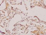 TGF beta-2 Antibody in Immunohistochemistry (Paraffin) (IHC (P))