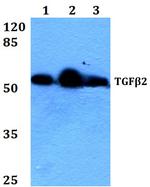 TGF beta-2 Antibody in Western Blot (WB)