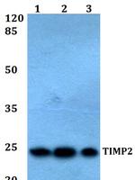 TIMP2 Antibody in Western Blot (WB)