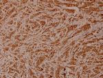 CHK2 Antibody in Immunohistochemistry (Paraffin) (IHC (P))