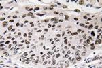 Cyclin D3 Antibody in Immunohistochemistry (Paraffin) (IHC (P))