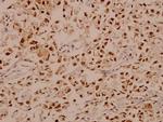 E2F1 Antibody in Immunohistochemistry (Paraffin) (IHC (P))