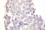 IKK beta Antibody in Immunohistochemistry (Paraffin) (IHC (P))