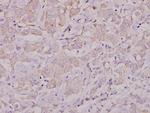 Lyn Antibody in Immunohistochemistry (Paraffin) (IHC (P))