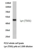 Lyn Antibody in Western Blot (WB)