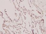 p130Cas Antibody in Immunohistochemistry (Paraffin) (IHC (P))