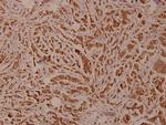 PLCG2 Antibody in Immunohistochemistry (Paraffin) (IHC (P))