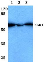 SGK1 Antibody in Western Blot (WB)