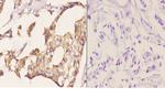 MDM2 Antibody in Immunohistochemistry (Paraffin) (IHC (P))