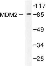 MDM2 Antibody in Western Blot (WB)