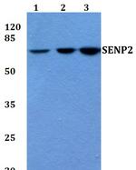 SENP2 Antibody in Western Blot (WB)