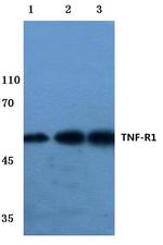 TNFR1 Antibody in Western Blot (WB)