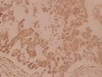 gamma Tubulin Antibody in Immunohistochemistry (Paraffin) (IHC (P))