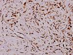 Vimentin Antibody in Immunohistochemistry (Paraffin) (IHC (P))