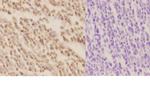 XPA Antibody in Immunohistochemistry (Paraffin) (IHC (P))