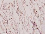 XRCC1 Antibody in Immunohistochemistry (Paraffin) (IHC (P))