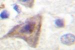 PRAS40 Antibody in Immunohistochemistry (Paraffin) (IHC (P))