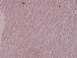 IKK beta Antibody in Immunohistochemistry (Paraffin) (IHC (P))