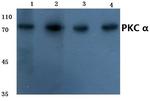 PKC alpha Antibody in Western Blot (WB)