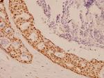 SOX9 Antibody in Immunohistochemistry (Paraffin) (IHC (P))