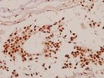 SP1 Antibody in Immunohistochemistry (Paraffin) (IHC (P))