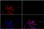 TSC2 Antibody in Immunocytochemistry (ICC/IF)