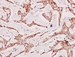 TSC2 Antibody in Immunohistochemistry (Paraffin) (IHC (P))