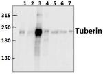 TSC2 Antibody in Western Blot (WB)