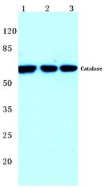 Catalase Antibody in Western Blot (WB)