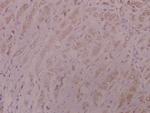 DNA-PK Antibody in Immunohistochemistry (Paraffin) (IHC (P))