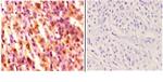 HDAC6 Antibody in Immunohistochemistry (Paraffin) (IHC (P))