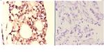 HDAC6 Antibody in Immunohistochemistry (Paraffin) (IHC (P))