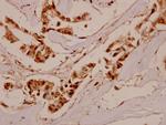 IFNGR1 Antibody in Immunohistochemistry (Paraffin) (IHC (P))