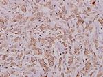 Aconitase 1 Antibody in Immunohistochemistry (Paraffin) (IHC (P))