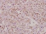 RPA2 Antibody in Immunohistochemistry (Paraffin) (IHC (P))