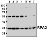 RPA2 Antibody in Western Blot (WB)