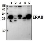 ERAB Antibody in Western Blot (WB)