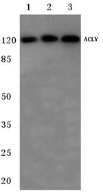 ATP Citrate Lyase Antibody in Western Blot (WB)