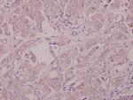 IFNAR1 Antibody in Immunohistochemistry (Paraffin) (IHC (P))