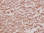 BCKDK Antibody in Immunohistochemistry (Paraffin) (IHC (P))