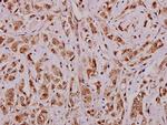 APRIL Antibody in Immunohistochemistry (Paraffin) (IHC (P))