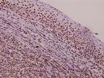 TROP2 Antibody in Immunohistochemistry (Paraffin) (IHC (P))