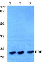 TPT1 Antibody in Western Blot (WB)