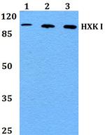 HK1 Antibody in Western Blot (WB)