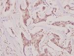 CMPK1 Antibody in Immunohistochemistry (Paraffin) (IHC (P))