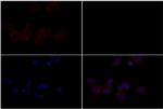 EphB4 Antibody in Immunocytochemistry (ICC/IF)