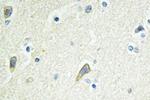 EphB4 Antibody in Immunohistochemistry (Paraffin) (IHC (P))